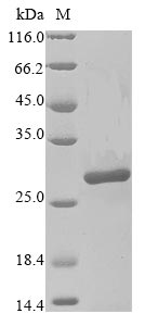 Greater than 85% as determined by SDS-PAGE.Recombinant Human Poly [Adp-Ribose] Polymerase 14 (PARP14) Protein (His&Myc)