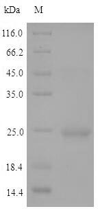 Greater than 90% as determined by SDS-PAGE.Recombinant Mouse-Ear Cress Histone Deacetylase Hdt2 (HDT2) Protein (His)