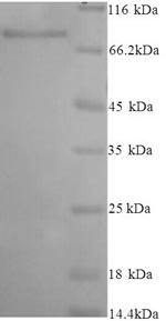 Greater than 90% as determined by SDS-PAGE.Recombinant Human Inactive N-Acetylated-Alpha-Linked Acidic Dipeptidase-Like Protein 2 (NAALADL2) Protein (His)
