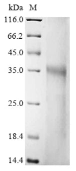 Greater than 90% as determined by SDS-PAGE.Recombinant Human Fibronectin Type Iii Domain-Containing Protein 3B (FNDC3B) Protein (His)