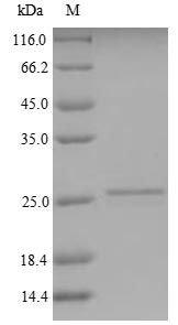 Greater than 90% as determined by SDS-PAGE.Recombinant Human Kita-Kyushu Lung Cancer Antigen 1 (CT83) Protein (His/Tag-Free)