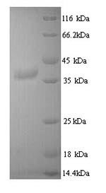Greater than 90% as determined by SDS-PAGE.Recombinant Mouse Tyrosine-Protein Kinase Jak3 (JAK3) Protein (His)