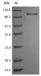Greater than 90% as determined by SDS-PAGE.Recombinant Mouse Receptor-Interacting Serine/Threonine-Protein Kinase 1 (RIPK1) Protein (His-SUMOSTAR)