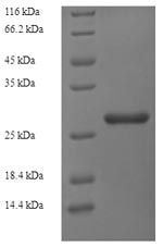 Greater than 90% as determined by SDS-PAGE.Recombinant Rat Ribosyldihydronicotinamide Dehydrogenase (NQO2) Protein (His)