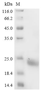 Greater than 90% as determined by SDS-PAGE.Recombinant Mouse Myelin-Oligodendrocyte Glycoprotein (MOG) Protein (His)