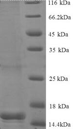 Greater than 90% as determined by SDS-PAGE.Recombinant Human Ben Domain-Containing Protein 3 (BEND3) Protein (His)