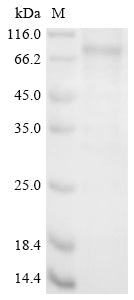 Greater than 85% as determined by SDS-PAGE.Recombinant Rat Cytochrome P450 1B1 (CYP1B1) Protein (His)