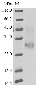 Greater than 85% as determined by SDS-PAGE.Recombinant Pongo Abelii Lysosome-Associated Membrane Glycoprotein 5 (LAMP5) Protein (His)