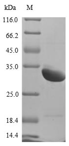 Greater than 85% as determined by SDS-PAGE.Recombinant Rat Sclerostin Domain-Containing Protein 1 (SOSTDC1) Protein (His&Myc)