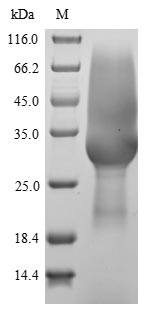 Greater than 85% as determined by SDS-PAGE.Recombinant Rat Sclerostin Domain-Containing Protein 1 (SOSTDC1) Protein (His-sumostar)