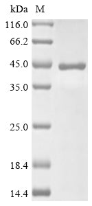 Greater than 85% as determined by SDS-PAGE.Recombinant Chinese Hamster Sialidase-2 (NEU2) Protein (His)