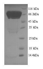Greater than 90% as determined by SDS-PAGE.Recombinant Human Autophagy-Related Protein 16-1 (ATG16L1) Protein (His)