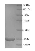 Greater than 90% as determined by SDS-PAGE.Recombinant Sudan Ebolavirus Envelope Glycoprotein (GP) Protein (His)