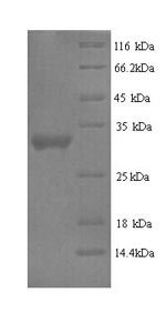 Greater than 90% as determined by SDS-PAGE.Recombinant Human Protein Delta Homolog 2 (DLK2) Protein (His)