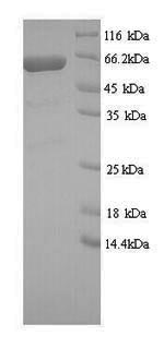 Greater than 90% as determined by SDS-PAGE.Recombinant Human Perq Amino Acid-Rich With Gyf Domain-Containing Protein 2 (GIGYF2) Protein (His)