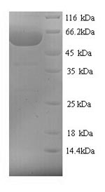 Greater than 90% as determined by SDS-PAGE.Recombinant Chamaecyparis Obtusa Polygalacturonase (PG) Protein (His)