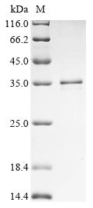 Greater than 85% as determined by SDS-PAGE.Recombinant Human Ras-Related Protein Rab-12 (RAB12) Protein (His)