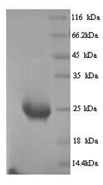 Greater than 90% as determined by SDS-PAGE.Recombinant Human Butyrophilin Subfamily 2 Member A1 (BTN2A1) Protein (His)