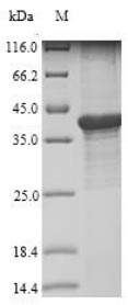 Greater than 85% as determined by SDS-PAGE.Recombinant Bartonella Henselae Lipoyl Synthase (LIPA) Protein (His)