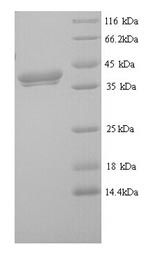 Greater than 90% as determined by SDS-PAGE.Recombinant Mouse Erythroferrone (ERFE) Protein (His)