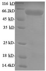 Greater than 90% as determined by SDS-PAGE.Recombinant Mouse Uncharacterized Aarf Domain-Containing Protein Kinase 2 (ADCK2) Protein (His/Tag-Free)