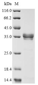 Greater than 85% as determined by SDS-PAGE.Recombinant Human Metapneumovirus Matrix Protein (M) Protein (His)