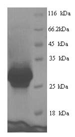 Greater than 90% as determined by SDS-PAGE.Recombinant Human Cementoblastoma-Derived Protein 1 (CEMP1) Protein (His)