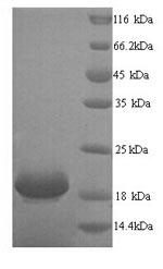 Greater than 90% as determined by SDS-PAGE.Recombinant Human Ly6/Plaur Domain-Containing Protein 6 (LYPD6) Protein (His)