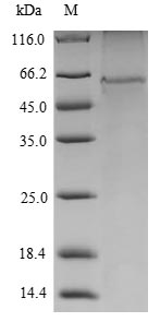 Greater than 85% as determined by SDS-PAGE.Recombinant Mouse Serine/Threonine-Protein Kinase Vrk1 (VRK1) Protein (His&Myc)