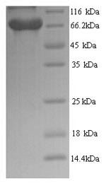 Greater than 90% as determined by SDS-PAGE.Recombinant Human Brca1-Associated Protein (BRAP) Protein (His)