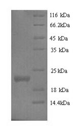 Greater than 90% as determined by SDS-PAGE.