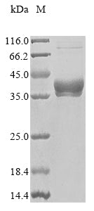 Greater than 90% as determined by SDS-PAGE.Recombinant Human 17-Beta-Hydroxysteroid Dehydrogenase 13 (HSD17B13) Protein (His&Myc)