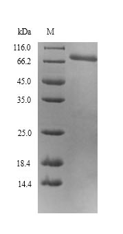 Greater than 90% as determined by SDS-PAGE.Recombinant Mouse Inactive Tyrosine-Protein Kinase 7 (PTK7) Protein (His/Tag-Free)