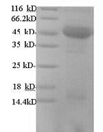 Greater than 90% as determined by SDS-PAGE.Recombinant Human M7Gpppn-Mrna Hydrolase (DCP2) Protein (His)