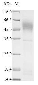Greater than 85% as determined by SDS-PAGE.Recombinant Human Pulmonary Surfactant-Associated Protein A1 (SFTPA1) Protein (His)