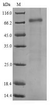 Greater than 90% as determined by SDS-PAGE.Recombinant Human Mrna-Decapping Enzyme 1B (DCP1B) Protein (His)