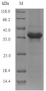 Greater than 90% as determined by SDS-PAGE.Recombinant Mouse Alpha/Beta Hydrolase Domain-Containing Protein 11 (ABHD11) Protein (His)