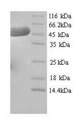 Greater than 90% as determined by SDS-PAGE.Recombinant Mouse Hydroxymethylglutaryl-Coa Synthase, Cytoplasmic Domain (HMGCS1) Protein (His)