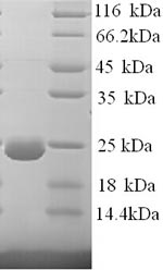 Greater than 90% as determined by SDS-PAGE.Recombinant Human Dystonin (DST) Protein (His)