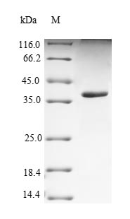 Greater than 90% as determined by SDS-PAGE.Recombinant Human Nectin-4 (NECTIN4) Protein (His)