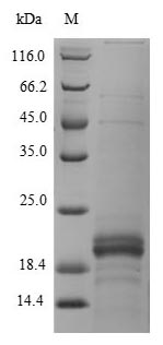 Greater than 90% as determined by SDS-PAGE.Recombinant Human Zymogen Granule Protein 16 Homolog B (ZG16B) Protein (His)