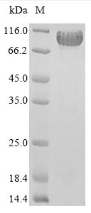 Greater than 85% as determined by SDS-PAGE.