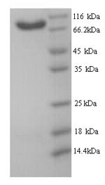 Greater than 90% as determined by SDS-PAGE.Recombinant Human B-Cell Scaffold Protein With Ankyrin Repeats (BANK1) Protein (His)