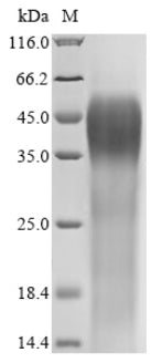 Greater than 85% as determined by SDS-PAGE.Recombinant Human Cation Channel Sperm-Associated Protein 1 (CATSPER1) Protein (His)
