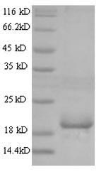 Greater than 90% as determined by SDS-PAGE.Recombinant Mouse Angiopoietin-Like Protein 8 (ANGPTL8) Protein (His)