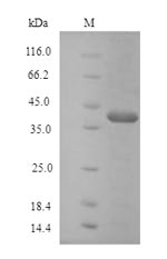 Greater than 90% as determined by SDS-PAGE.Recombinant Human Protein Atonal Homolog 1 (ATOH1) Protein (His)