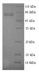 Greater than 90% as determined by SDS-PAGE.Recombinant Human N-Acetylmuramoyl-L-Alanine Amidase (PGLYRP2) Protein (His)