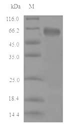 Greater than 90% as determined by SDS-PAGE.Recombinant Mouse Cystathionine Beta-Synthase (CBS) Protein (His)