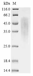 Greater than 85% as determined by SDS-PAGE.Recombinant Human Rad51-Associated Protein 1 (RAD51AP1) Protein (His)