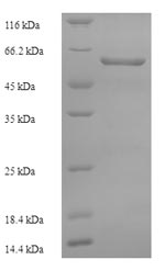 Greater than 90% as determined by SDS-PAGE.Recombinant Human Pseudokinase Fam20A (FAM20A) Protein (His)